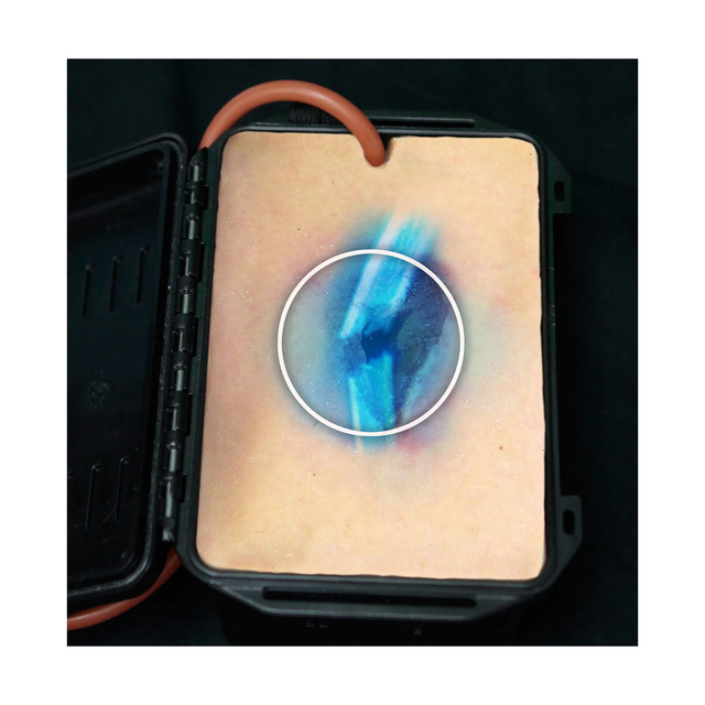 Trenazer-tamowania-krwotoku-rana-odlamkowa-Shrapnel-Wound-in-a-Box®-3